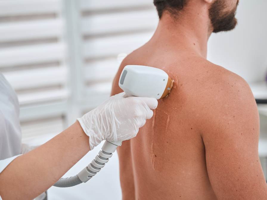 hombre depilacion laser palermo caba