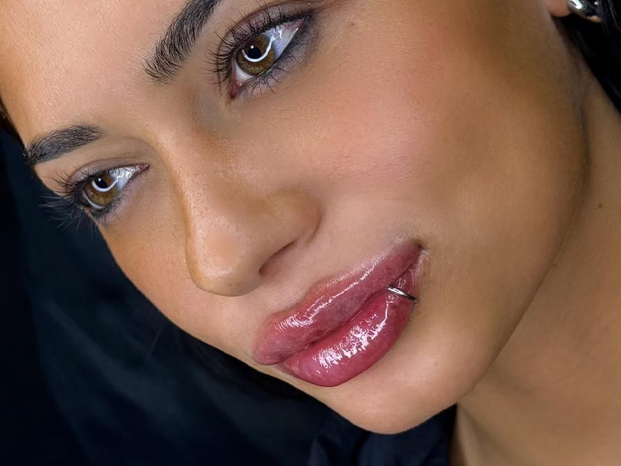 mujer labios acido hialuronico