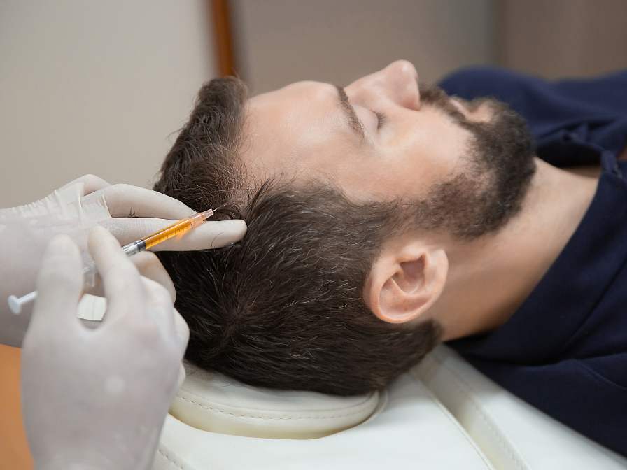 prp plasma rico en plaquetas capilar hombre